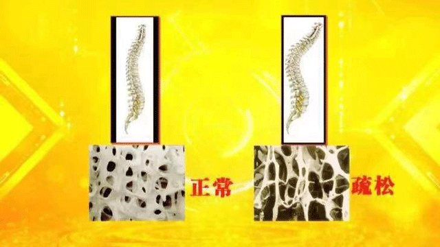 為什么老年人習(xí)(xí)慣背手走路？