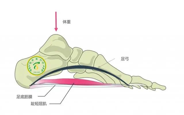 無(wú)創(chuàng)(chuàng)傷，無(wú)輻射，體外沖擊波康復(fù)治療為足跟痛患者帶來(lái)康復(fù)新希望!
