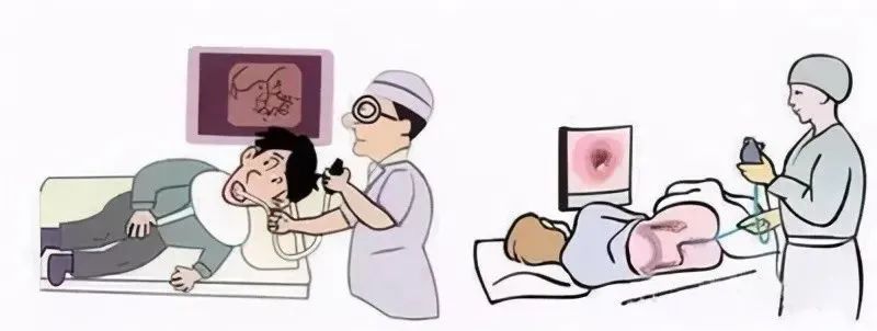 揭秘胃腸鏡檢查的8大謠言，別再被誤導(dǎo)(dǎo)了！