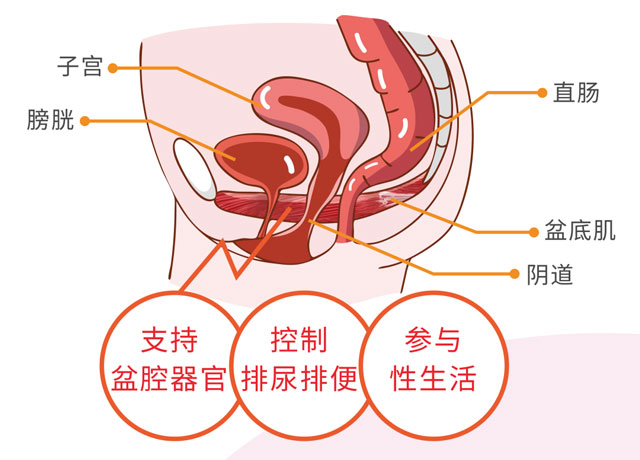 女性漏尿，趕緊查查盆底功能是否出了問題！