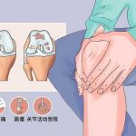 干貨！永林骨傷專家談老年骨性膝關(guān)節(jié)(jié)炎的防治