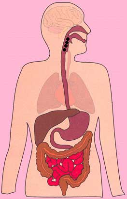 消化道腫瘤高發(fā)(fā)，胃腸鏡檢查有時(shí)真的能“救命”！