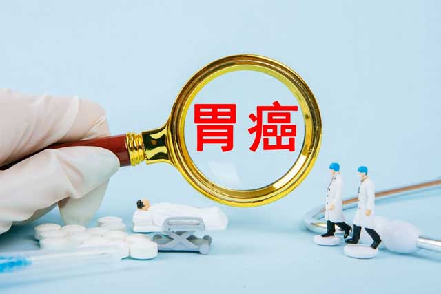 胃腸消化道腫瘤高發(fā)(fā)，胃腸鏡檢查可實(shí)(shí)現(xiàn)(xiàn)早診早治！這些人群建議盡早檢查！